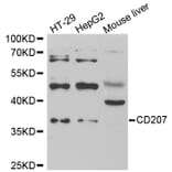 Western blot - CD207 antibody from Signalway Antibody (39003) - Antibodies.com