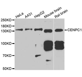 Western blot - CENPC antibody from Signalway Antibody (39005) - Antibodies.com