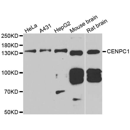 Western blot - CENPC antibody from Signalway Antibody (39005) - Antibodies.com