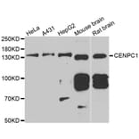 Western blot - CENPC antibody from Signalway Antibody (39005) - Antibodies.com