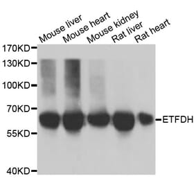 Western blot - ETFDH antibody from Signalway Antibody (39025) - Antibodies.com