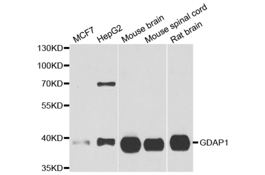 Western blot - GDAP1 antibody from Signalway Antibody (39036) - Antibodies.com