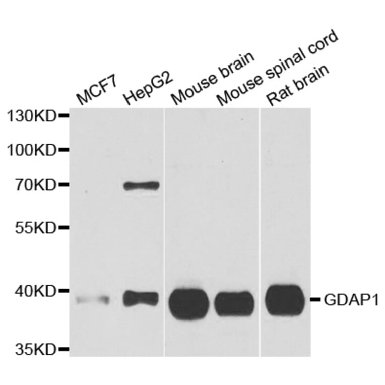 Western blot - GDAP1 antibody from Signalway Antibody (39036) - Antibodies.com