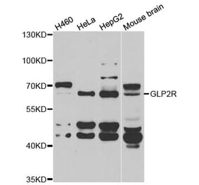 Western blot - GLP2R antibody from Signalway Antibody (39037) - Antibodies.com