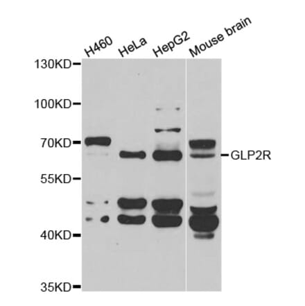 Western blot - GLP2R antibody from Signalway Antibody (39037) - Antibodies.com