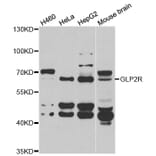 Western blot - GLP2R antibody from Signalway Antibody (39037) - Antibodies.com