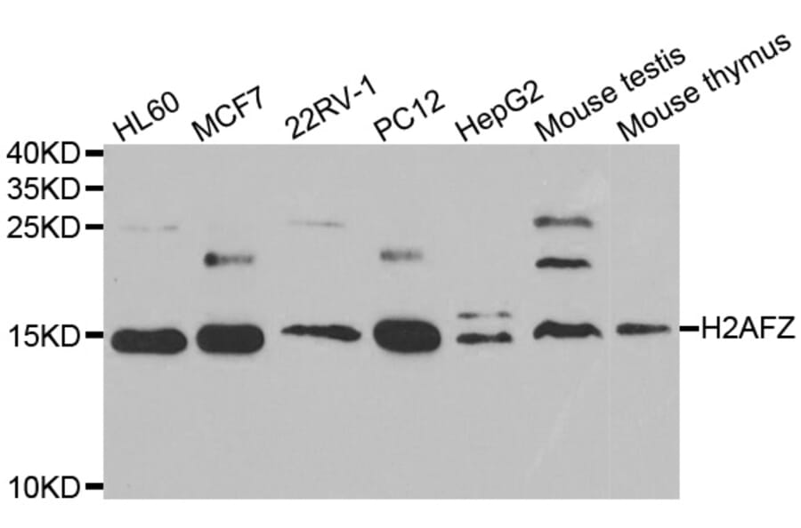 Western blot - H2AFZ antibody from Signalway Antibody (39046) - Antibodies.com