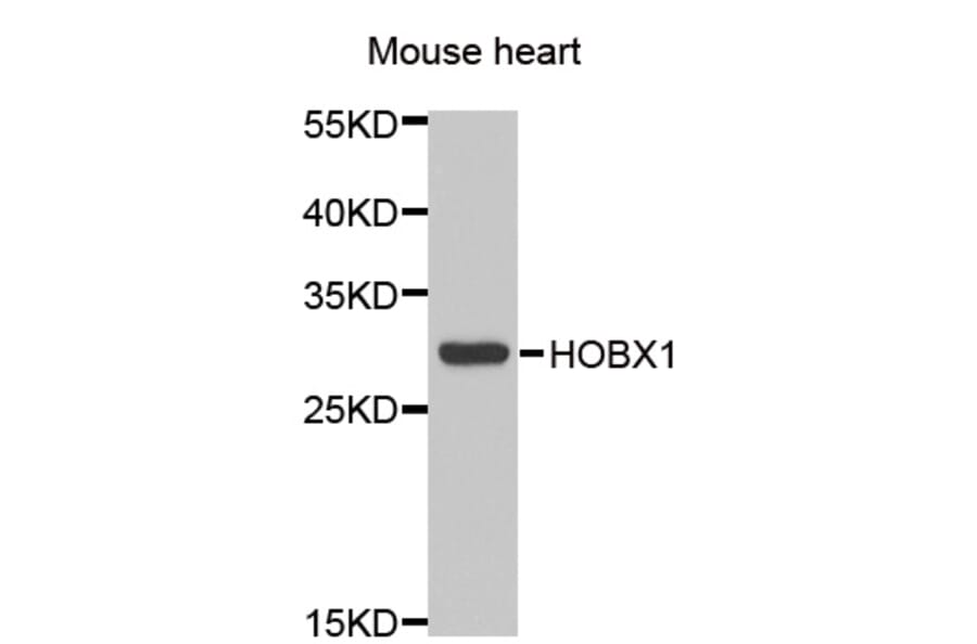 Western blot - HOXB1 antibody from Signalway Antibody (39050) - Antibodies.com