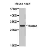 Western blot - HOXB1 antibody from Signalway Antibody (39050) - Antibodies.com