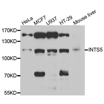 Western blot - INTS5 antibody from Signalway Antibody (39059) - Antibodies.com