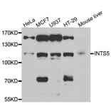 Western blot - INTS5 antibody from Signalway Antibody (39059) - Antibodies.com