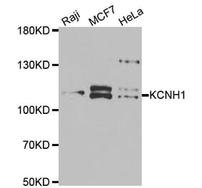 Western blot - KCNH1 antibody from Signalway Antibody (39061) - Antibodies.com