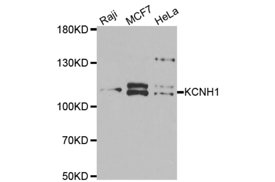 Western blot - KCNH1 antibody from Signalway Antibody (39061) - Antibodies.com