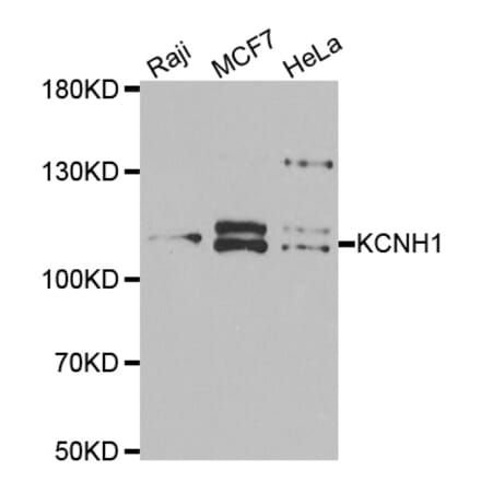 Western blot - KCNH1 antibody from Signalway Antibody (39061) - Antibodies.com