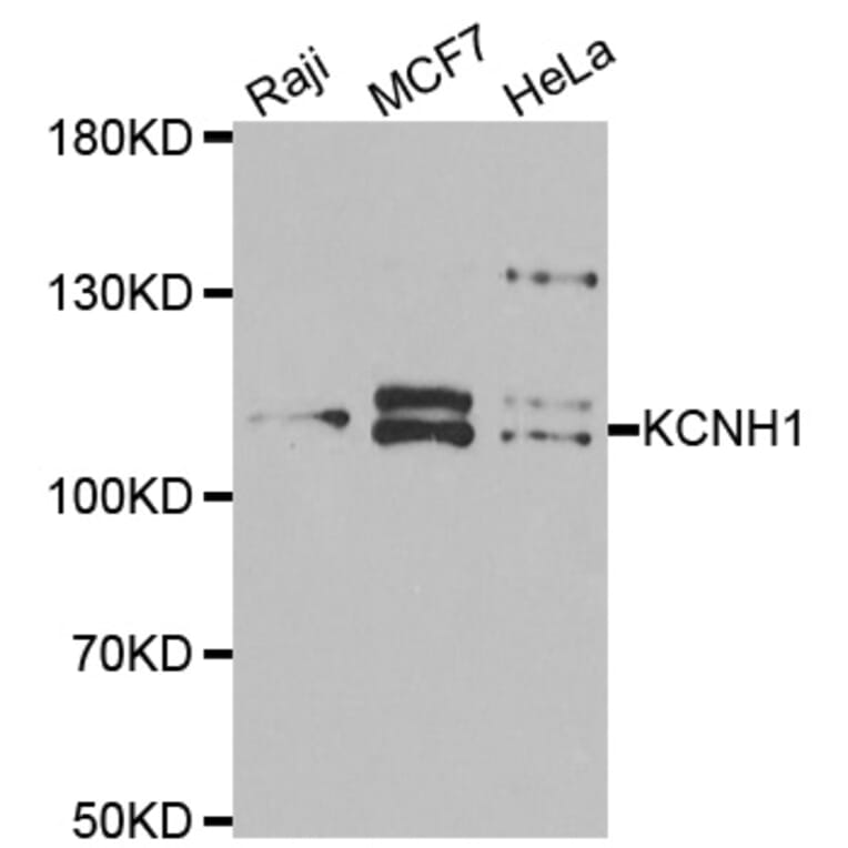 Western blot - KCNH1 antibody from Signalway Antibody (39061) - Antibodies.com