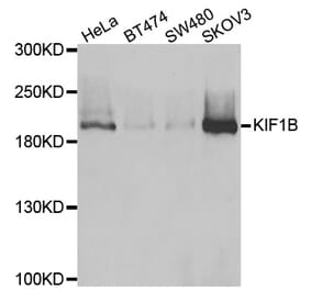Western blot - KIF1B antibody from Signalway Antibody (39063) - Antibodies.com