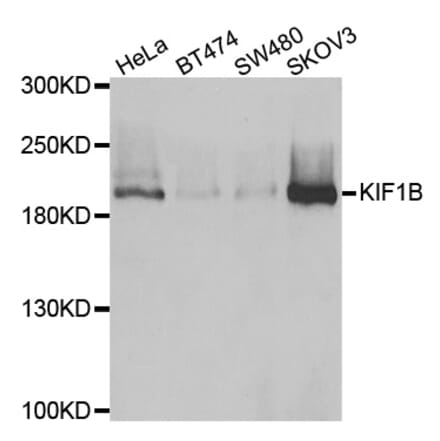 Western blot - KIF1B antibody from Signalway Antibody (39063) - Antibodies.com