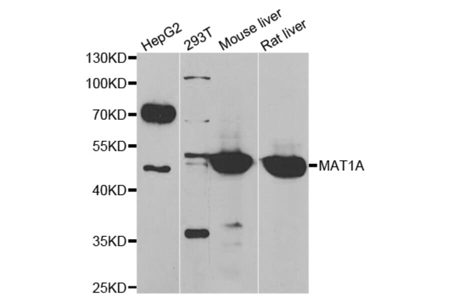 Western blot - MAT1A antibody from Signalway Antibody (39071) - Antibodies.com
