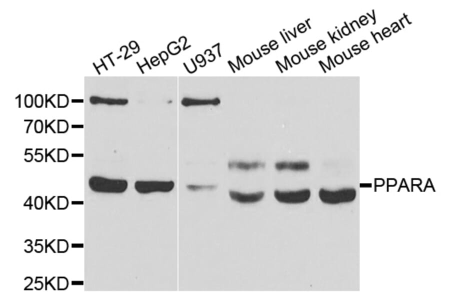 Western blot - PPARA antibody from Signalway Antibody (39110) - Antibodies.com