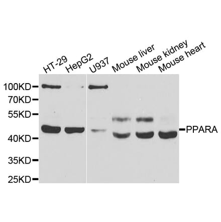 Western blot - PPARA antibody from Signalway Antibody (39110) - Antibodies.com