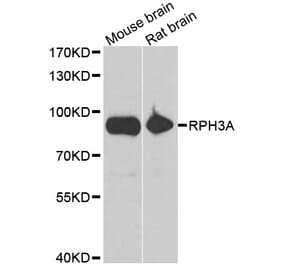 Western blot - RPH3A antibody from Signalway Antibody (39129) - Antibodies.com