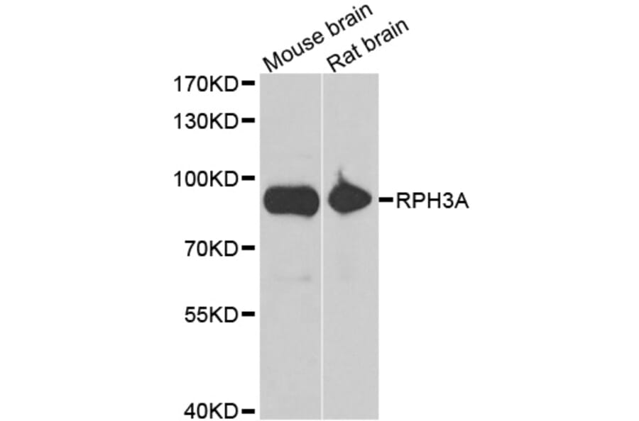 Western blot - RPH3A antibody from Signalway Antibody (39129) - Antibodies.com