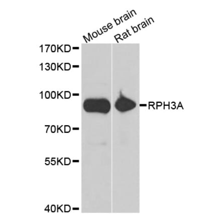 Western blot - RPH3A antibody from Signalway Antibody (39129) - Antibodies.com