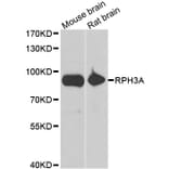 Western blot - RPH3A antibody from Signalway Antibody (39129) - Antibodies.com