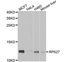 Western blot - RPS27 antibody from Signalway Antibody (39135) - Antibodies.com