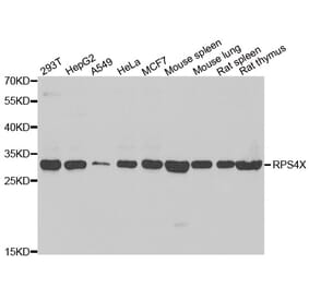 Western blot - RPS4X antibody from Signalway Antibody (39136) - Antibodies.com