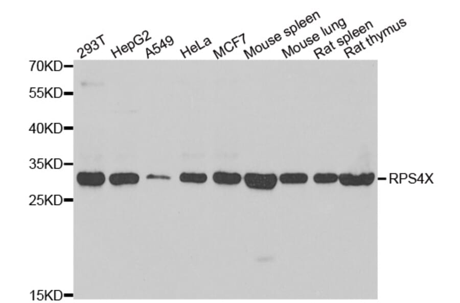 Western blot - RPS4X antibody from Signalway Antibody (39136) - Antibodies.com