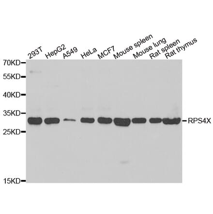 Western blot - RPS4X antibody from Signalway Antibody (39136) - Antibodies.com