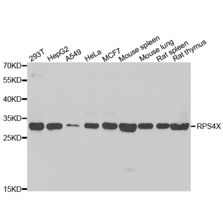 Western blot - RPS4X antibody from Signalway Antibody (39136) - Antibodies.com