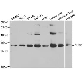 Western blot - SURF1 antibody from Signalway Antibody (39156) - Antibodies.com