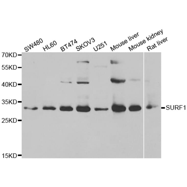 Western blot - SURF1 antibody from Signalway Antibody (39156) - Antibodies.com