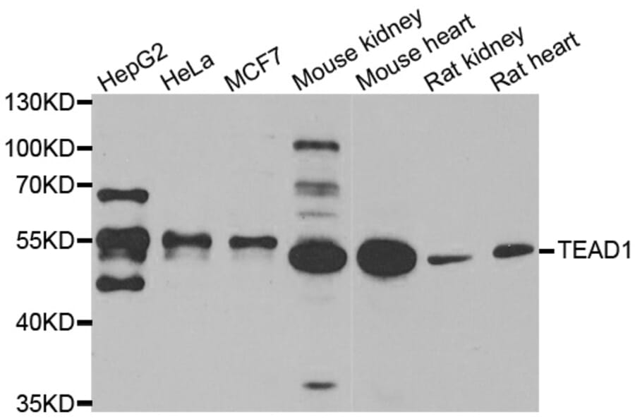 Western blot - TEAD1 antibody from Signalway Antibody (39165) - Antibodies.com