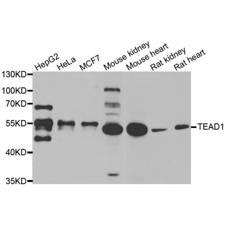 Western blot - TEAD1 antibody from Signalway Antibody (39165) - Antibodies.com