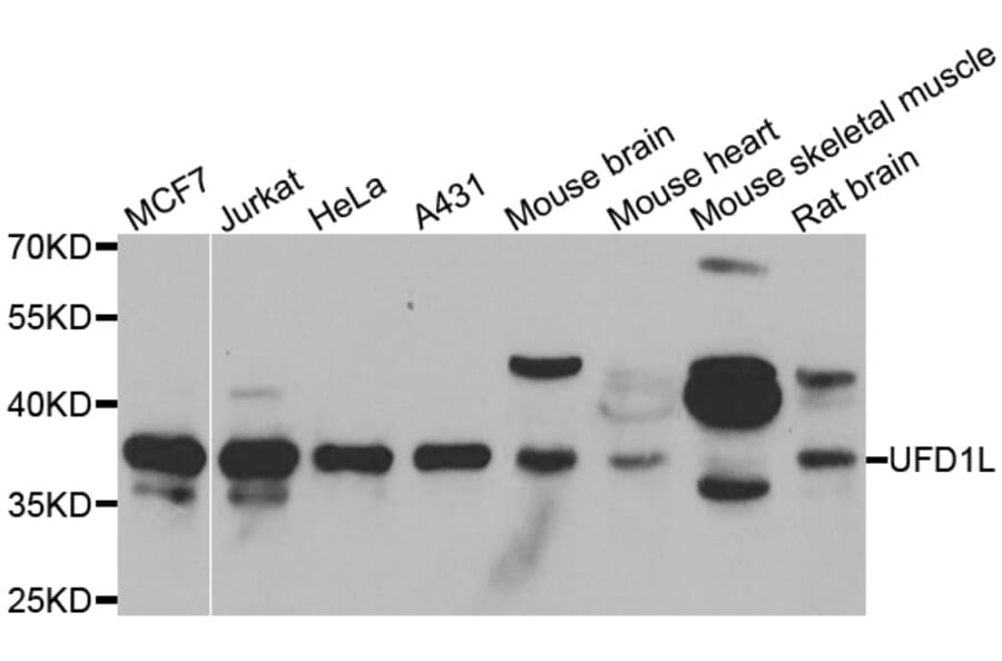 Western blot - UFD1L antibody from Signalway Antibody (39179) - Antibodies.com