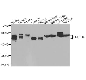 Western blot - SETD6 antibody from Signalway Antibody (39189) - Antibodies.com