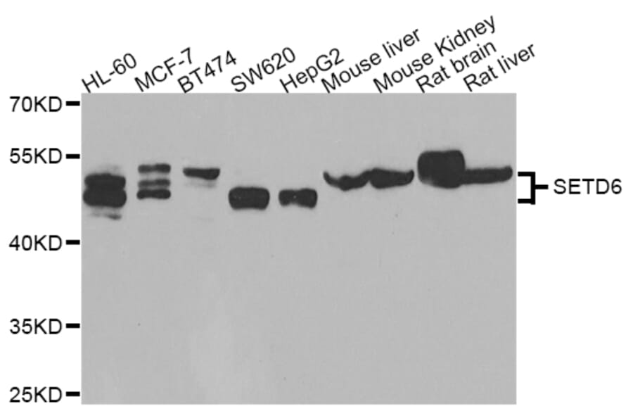 Western blot - SETD6 antibody from Signalway Antibody (39189) - Antibodies.com