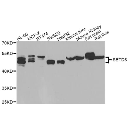 Western blot - SETD6 antibody from Signalway Antibody (39189) - Antibodies.com