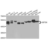 Western blot - SETD6 antibody from Signalway Antibody (39189) - Antibodies.com