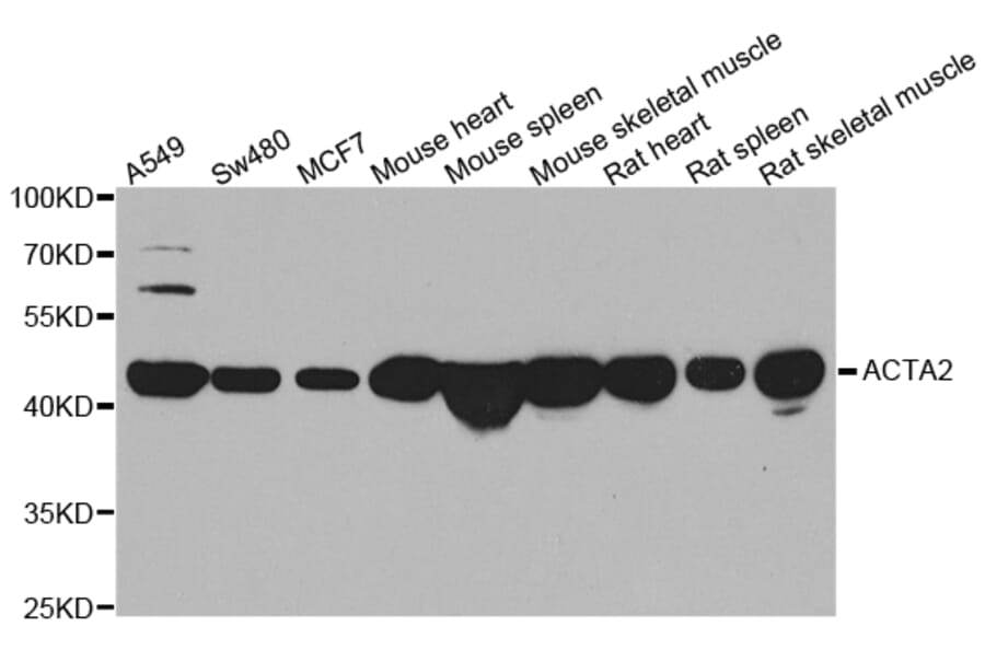 Western blot - ACTA2 antibody from Signalway Antibody (39192) - Antibodies.com