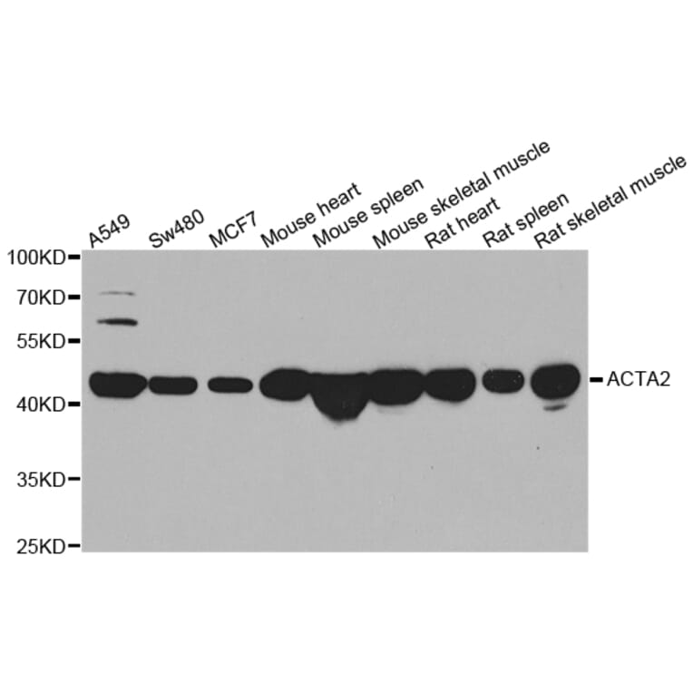 Western blot - ACTA2 antibody from Signalway Antibody (39192) - Antibodies.com