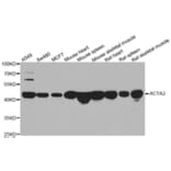Western blot - ACTA2 antibody from Signalway Antibody (39192) - Antibodies.com