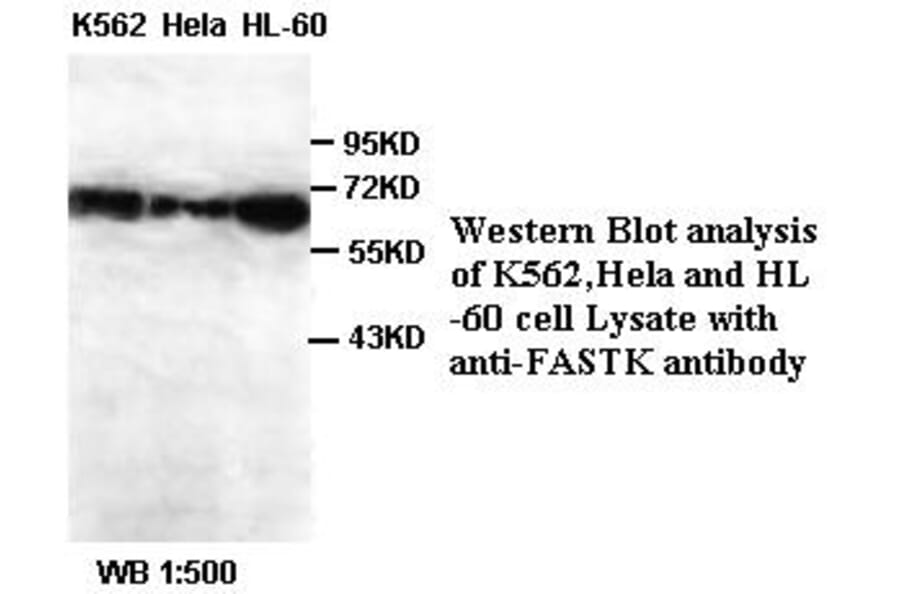 FASTK Antibody from Signalway Antibody (39388) - Antibodies.com
