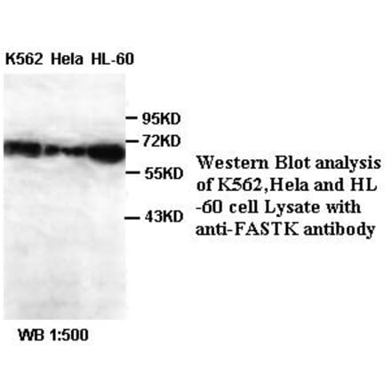 FASTK Antibody from Signalway Antibody (39388) - Antibodies.com