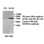 MMP24 Antibody from Signalway Antibody (39407) - Antibodies.com
