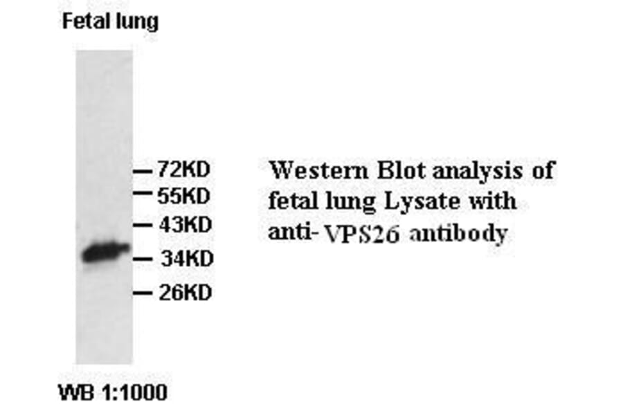 VPS26 Antibody from Signalway Antibody (39420) - Antibodies.com
