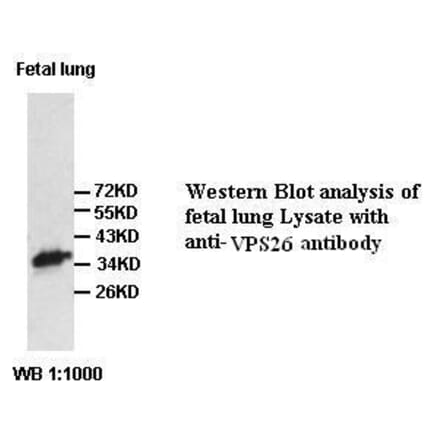 VPS26 Antibody from Signalway Antibody (39420) - Antibodies.com